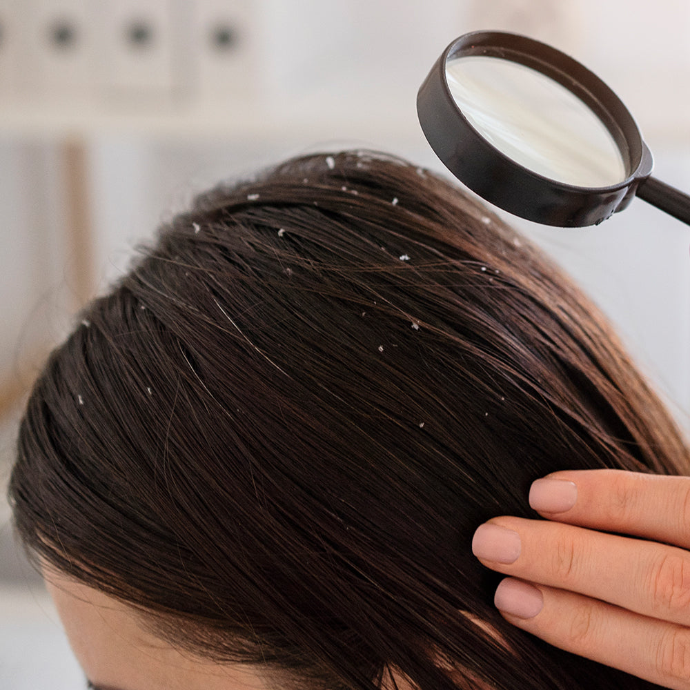 Dandruff Testing Card Anti Dandruff Evaluation | Mascot Spincontrol India Pvt Ltd